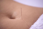 Acupuncture Fertility Treatments in Margate, Coral Springs, Coconut Creek, Boca Raton, Ft. Lauderdale, Parkland